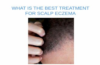 WHAT IS THE BEST TREATMENT FOR SCALP ECZEMA?